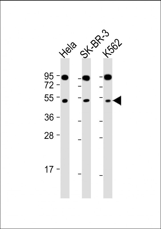 WB - SLC16A13 Antibody (C-term) AP11410b