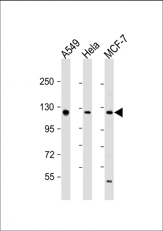 All lanes : Anti-SIRT1 Antibody (C-term) at 1:2000 dilutionLane 1: A549 whole cell lysateLane 2: Hela whole cell lysateLane 3: MCF-7 whole cell lysateLysates/proteins at 20 �g per lane. SecondaryGoat Anti-Rabbit IgG,  (H+L), Peroxidase conjugated at 1/10000 dilution. Predicted band size : 82 kDaBlocking/Dilution buffer: 5% NFDM/TBST.