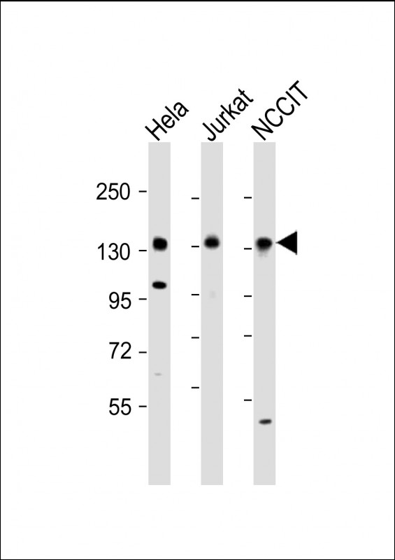 WB - PHC1 Antibody (N-Term) AP21886a
