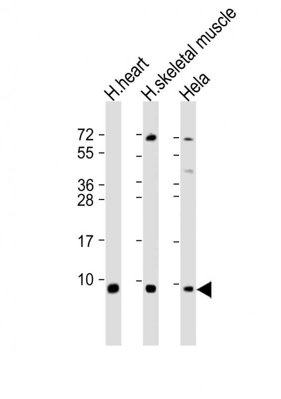 All lanes : Anti-ATP5E Antibody (C-Term) at 1:2000 dilutionLane 1: human heart lysateLane 2: human skeletal muscle lysateLane 3: Hela whole cell lysateLysates/proteins at 20 �g per lane. SecondaryGoat Anti-Rabbit IgG,  (H+L), Peroxidase conjugated at 1/10000 dilution. Predicted band size : 6 kDaBlocking/Dilution buffer: 5% NFDM/TBST.