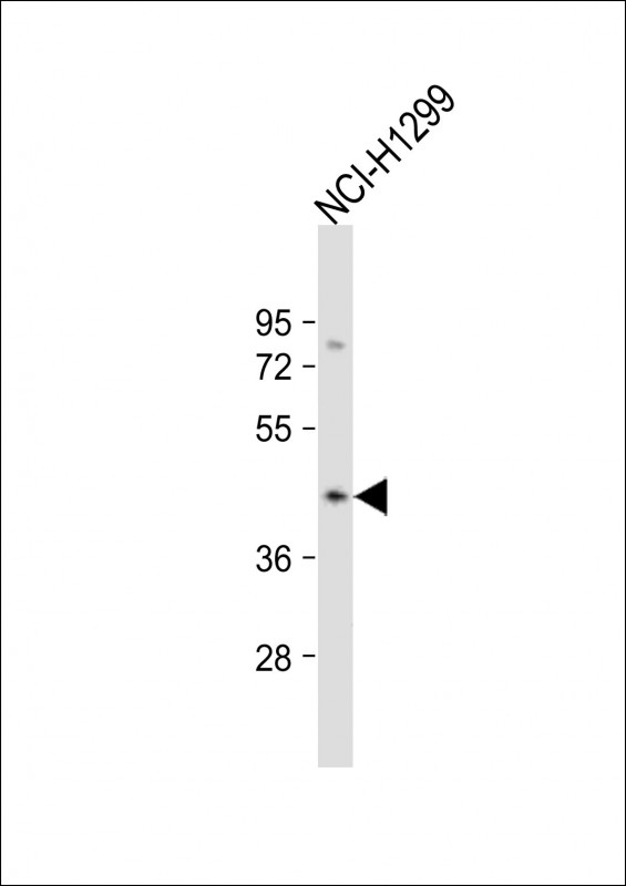 Anti-CSNK2A3 Antibody (N-Term) at 1:2000 dilution + NCI-H1299 whole cell lysateLysates/proteins at 20 �g per lane. SecondaryGoat Anti-Rabbit IgG,  (H+L), Peroxidase conjugated at 1/10000 dilution. Predicted band size : 45 kDaBlocking/Dilution buffer: 5% NFDM/TBST.