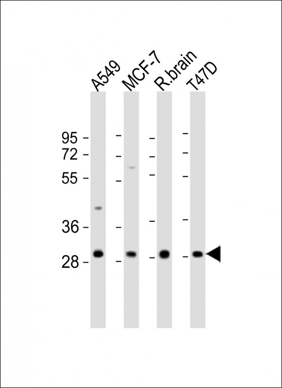 All lanes : Anti-ACBD4 Antibody (Center) at 1:2000 dilutionLane 1: A549 whole cell lysateLane 2: MCF-7 whole cell lysateLane 3: rat brain lysateLane 4: T47D whole cell lysateLysates/proteins at 20 �g per lane. SecondaryGoat Anti-Rabbit IgG,  (H+L), Peroxidase conjugated at 1/10000 dilution. Predicted band size : 30 kDaBlocking/Dilution buffer: 5% NFDM/TBST.