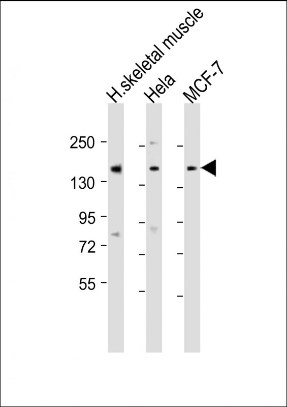 All lanes : Anti-TNRC6A Antibody (Center) at 1:1000-1:2000 dilutionLane 1: human skeletal muscle lysateLane 2: Hela whole cell lysateLane 3: MCF-7 whole cell lysateLysates/proteins at 20 �g per lane. SecondaryGoat Anti-Rabbit IgG,  (H+L), Peroxidase conjugated at 1/10000 dilution. Predicted band size : 210 kDaBlocking/Dilution buffer: 5% NFDM/TBST.