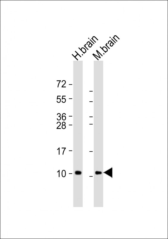 All lanes : Anti-GNG2 Antibody (N-Term) at 1:8000 dilutionLane 1: human brain lysateLane 2: mouse brain lysateLysates/proteins at 20 �g per lane. SecondaryGoat Anti-Rabbit IgG,  (H+L), Peroxidase conjugated at 1/10000 dilution. Predicted band size : 8 kDaBlocking/Dilution buffer: 5% NFDM/TBST.