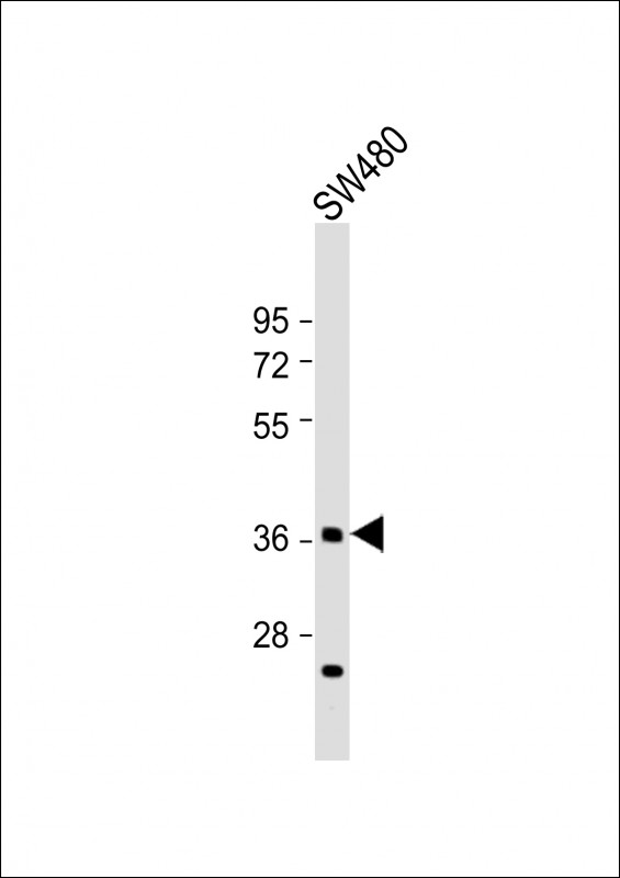 WB - DEDD2 Antibody (Center) AP21912c