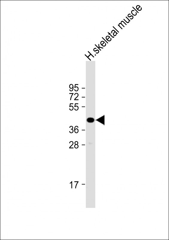 WB - TMEM115 Antibody (C-Term) AP21934b