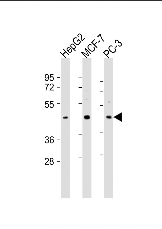 All lanes : Anti-SAPCD2 Antibody (C-Term) at 1:2000 dilutionLane 1: HepG2 whole cell lysateLane 2: MCF-7 whole cell lysateLane 3: PC-3 whole cell lysateLysates/proteins at 20 �g per lane. SecondaryGoat Anti-Rabbit IgG,  (H+L), Peroxidase conjugated at 1/10000 dilution. Predicted band size : 43 kDaBlocking/Dilution buffer: 5% NFDM/TBST.