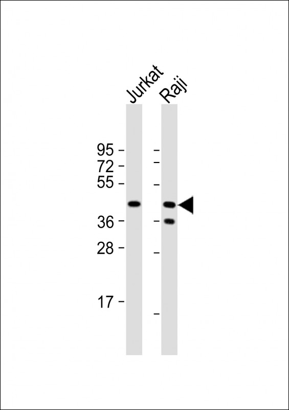 All lanes : Anti-ST6 Antibody (C253) at 1:1000 dilutionLane 1: Jurkat whole cell lysateLane 2: Raji whole cell lysateLysates/proteins at 20 �g per lane.  SecondaryGoat Anti-Rabbit IgG,   (H+L),  Peroxidase conjugated at 1/10000 dilution.  Predicted band size : 30 kDaBlocking/Dilution buffer: 5% NFDM/TBST.