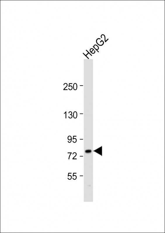 Anti-ABCG1 Antibody (Center) at 1:1000 dilution + HepG2 whole cell lysateLysates/proteins at 20 �g per lane. SecondaryGoat Anti-Rabbit IgG,  (H+L), Peroxidase conjugated at 1/10000 dilution. Predicted band size : 76 kDaBlocking/Dilution buffer: 5% NFDM/TBST.