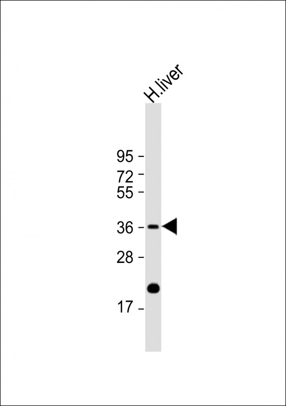 Anti-IGFBP-3 Antibody at 1:1000 dilution + human liver lysateLysates/proteins at 20 �g per lane. SecondaryGoat Anti-Rabbit IgG,  (H+L), Peroxidase conjugated at 1/10000 dilution. Predicted band size : 32 kDaBlocking/Dilution buffer: 5% NFDM/TBST.