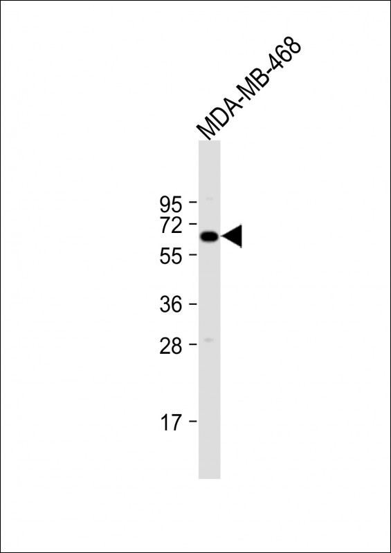 Anti-YES Antibody (K11) at 1:1000 dilution + MDA-MB-468 whole cell lysateLysates/proteins at 20 �g per lane. SecondaryGoat Anti-Rabbit IgG,  (H+L), Peroxidase conjugated at 1/10000 dilution. Predicted band size : 61 kDaBlocking/Dilution buffer: 5% NFDM/TBST.