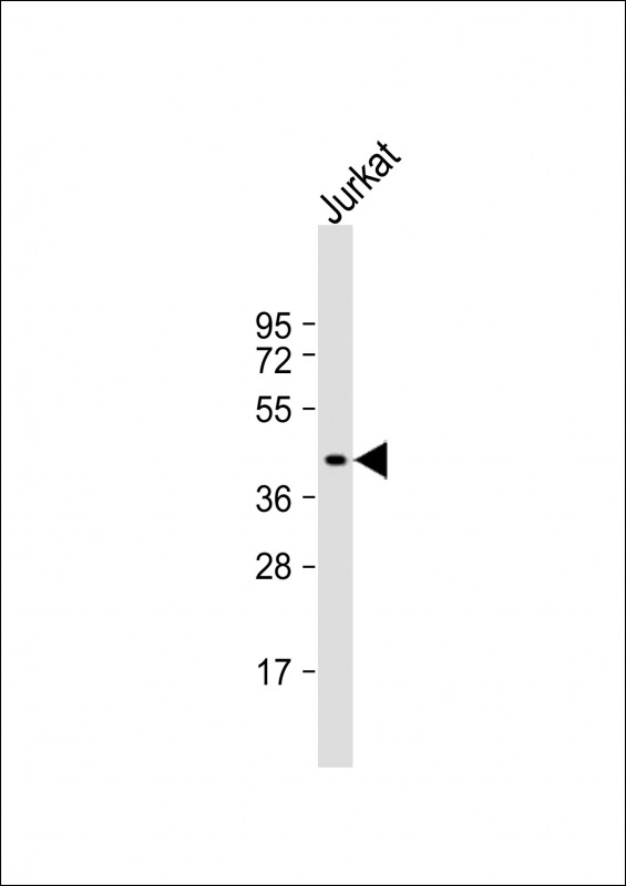 Anti-PIM1 Antibody (E298) at 1:1000 dilution + Jurkat whole cell lysateLysates/proteins at 20 �g per lane. SecondaryGoat Anti-Rabbit IgG,  (H+L), Peroxidase conjugated at 1/10000 dilution. Predicted band size : 45 kDaBlocking/Dilution buffer: 5% NFDM/TBST.