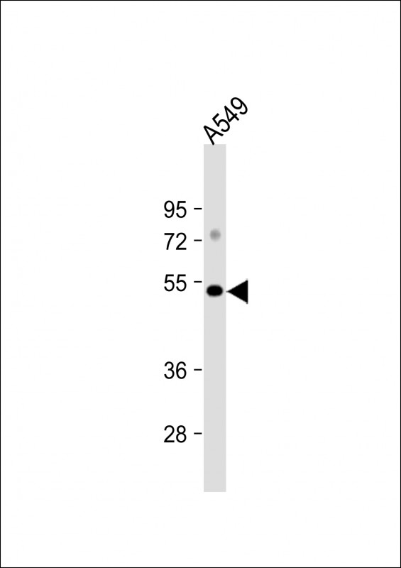 Anti-GSK3A Antibody (E463) at 1:1000 dilution + A549 whole cell lysateLysates/proteins at 20 �g per lane. SecondaryGoat Anti-Rabbit IgG,  (H+L), Peroxidase conjugated at 1/10000 dilution. Predicted band size : 51 kDaBlocking/Dilution buffer: 5% NFDM/TBST.