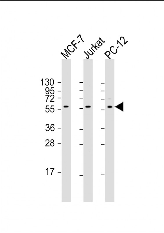 All lanes : Anti-AKT2 Antibody at 1:2000 dilutionLane 1: MCF-7 whole cell lysateLane 2: Jurkat whole cell lysateLane 3: PC-12 whole cell lysateLysates/proteins at 20 �g per lane. SecondaryGoat Anti-mouse IgG,  (H+L), Peroxidase conjugated at 1/10000 dilution. Predicted band size : 56 kDaBlocking/Dilution buffer: 5% NFDM/TBST.