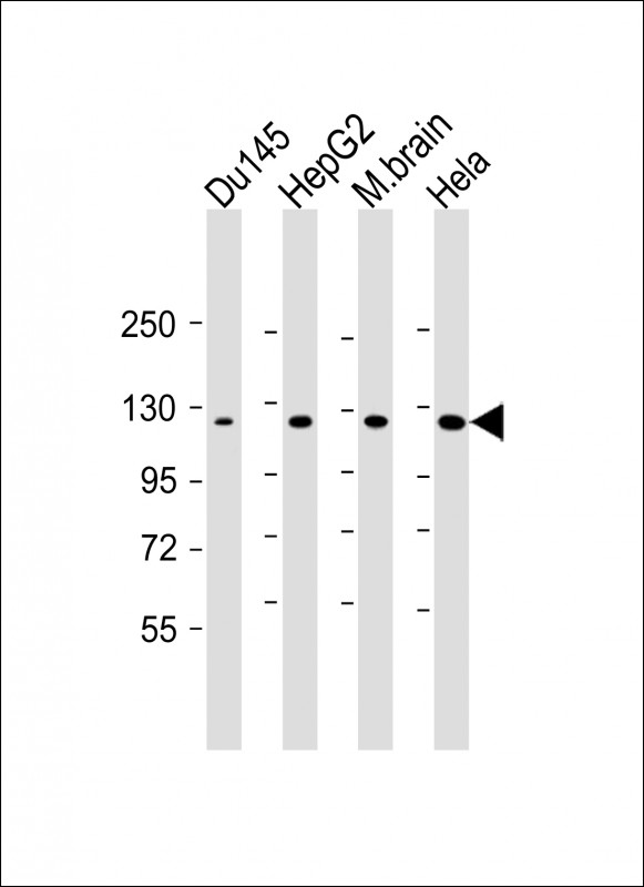 All lanes : Anti-DAB2IP Antibody at 1:1000 dilutionLane 1: Du145 whole cell lysateLane 2: HepG2 whole cell lysateLane 3: mouse brain lysateLane 4: Hela whole cell lysateLysates/proteins at 20 �g per lane.  SecondaryGoat Anti-mouse IgG,   (H+L),  Peroxidase conjugated at 1/10000 dilution.  Predicted band size : 132 kDaBlocking/Dilution buffer: 5% NFDM/TBST.