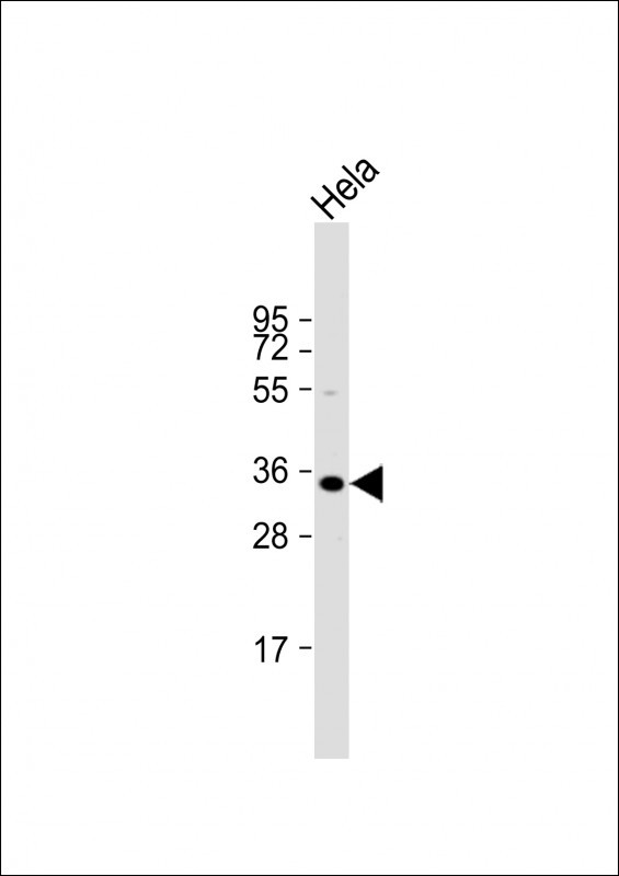 WB - ARV1 Antibody  (N-term) AP10655a