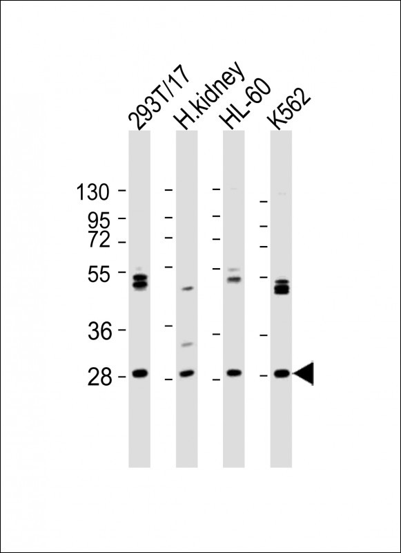 WB - ARV1 Antibody  (N-term) AP10655a