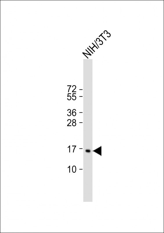 Anti-CDKN2C Antibody (C-term) at 1:2000 dilution + NIH/3T3 whole cell lysateLysates/proteins at 20 �g per lane. SecondaryGoat Anti-Rabbit IgG,  (H+L), Peroxidase conjugated at 1/10000 dilution. Predicted band size : 18 kDaBlocking/Dilution buffer: 5% NFDM/TBST.