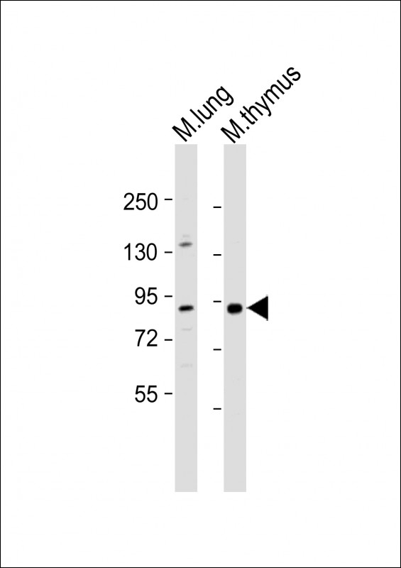 All lanes : Anti-Parp9 Antibody (C-term) at 1:1000 dilutionLane 1: mouse lung lysateLane 2: mouse thymus lysateLysates/proteins at 20 �g per lane. SecondaryGoat Anti-Rabbit IgG,  (H+L), Peroxidase conjugated at 1/10000 dilution. Predicted band size : 97 kDaBlocking/Dilution buffer: 5% NFDM/TBST.