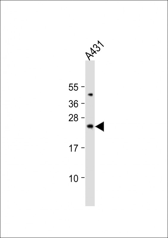 WB - Bad Antibody (Center) AP1314C
