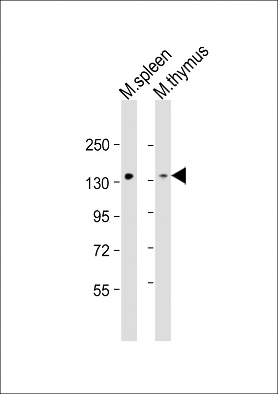 WB - Mouse Stk10 Antibody (C-term) AP14636b