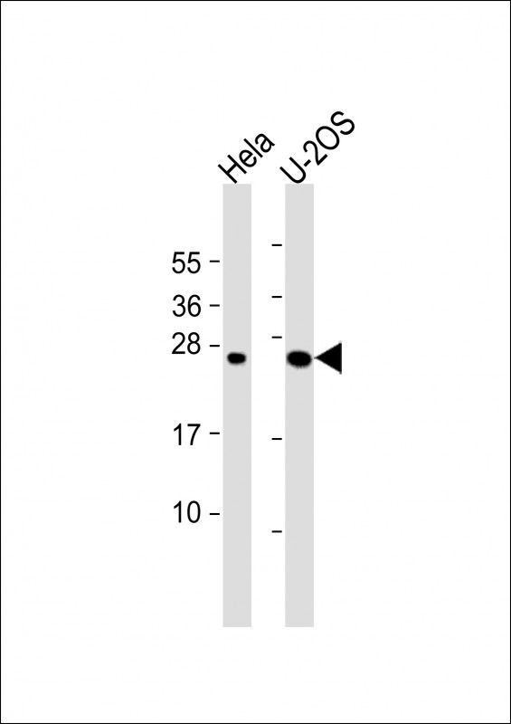 WB - DCTN6 Antibody (Center) AP17686c