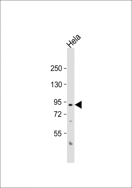 Anti-Aconitase Antibody at 1:1000 dilution + Hela whole cell lysateLysates/proteins at 20 �g per lane. SecondaryGoat Anti-Rabbit IgG,  (H+L), Peroxidase conjugated at 1/10000 dilution. Predicted band size : 85 kDaBlocking/Dilution buffer: 5% NFDM/TBST.