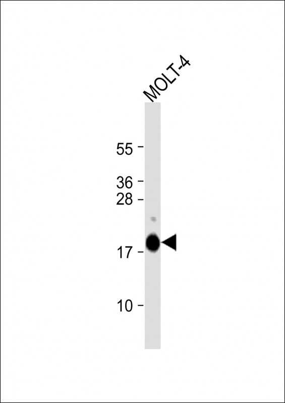 Anti-UBE2L6 Antibody (K136) at 1:1000 dilution + MOLT-4 whole cell lysateLysates/proteins at 20 �g per lane. SecondaryGoat Anti-Rabbit IgG,  (H+L), Peroxidase conjugated at 1/10000 dilution. Predicted band size : 18 kDaBlocking/Dilution buffer: 5% NFDM/TBST.