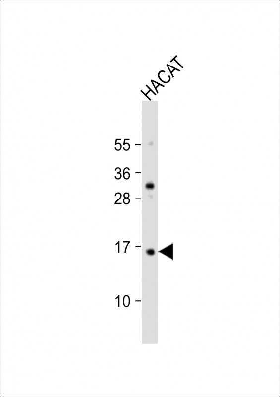 WB - TCTA Antibody (N-Term) AP21962a