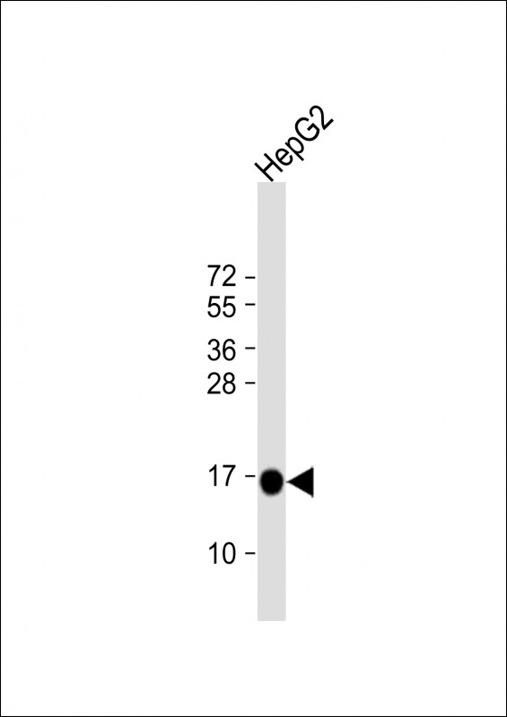 Anti-MGST1 Antibody (Center) at 1:4000 dilution + HepG2 whole cell lysateLysates/proteins at 20 �g per lane. SecondaryGoat Anti-Rabbit IgG,  (H+L), Peroxidase conjugated at 1/10000 dilution. Predicted band size : 18 kDaBlocking/Dilution buffer: 5% NFDM/TBST.
