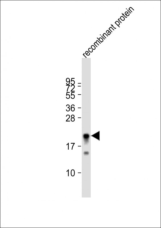 Anti-MLL2 Antibody (T4720) at 1:80000 dilution + recombinant protein whole cell lysateLysates/proteins at 20 �g per lane.    SecondaryGoat Anti-Rabbit IgG,     (H+L),    Peroxidase conjugated at 1/10000 dilution.    Predicted band size : 593 kDaBlocking/Dilution buffer: 5% NFDM/TBST.