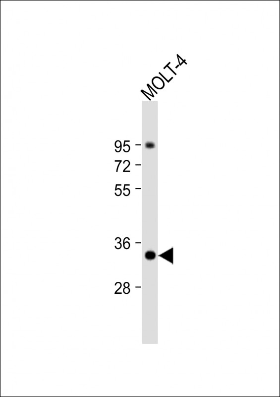Anti-ZWINT Antibody (Center) at 1:1000 dilution + MOLT-4 whole cell lysateLysates/proteins at 20 �g per lane. SecondaryGoat Anti-Rabbit IgG,  (H+L), Peroxidase conjugated at 1/10000 dilution. Predicted band size : 31 kDaBlocking/Dilution buffer: 5% NFDM/TBST.