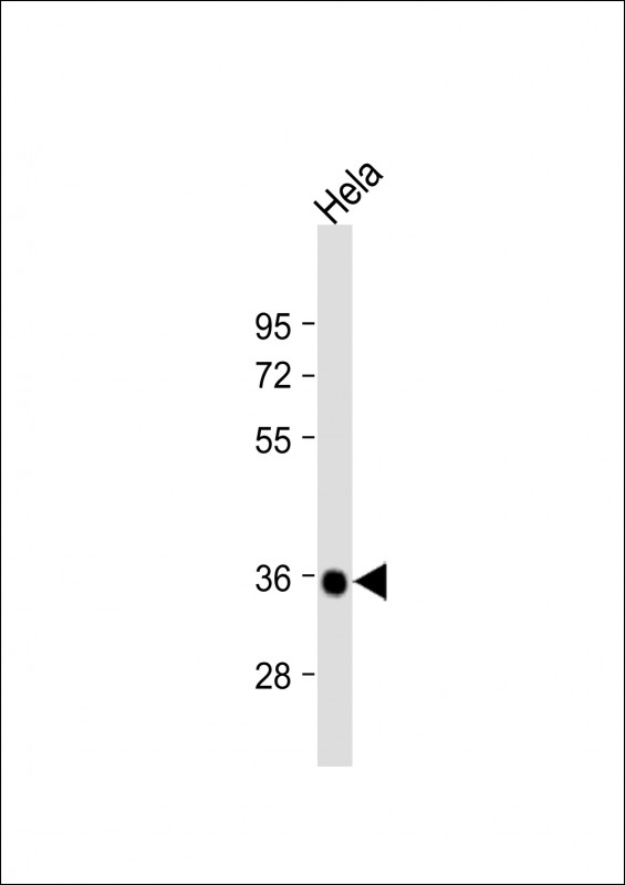 Anti-DGUOK Antibody (F256) at 1:1000 dilution + Hela whole cell lysateLysates/proteins at 20 �g per lane. SecondaryGoat Anti-Rabbit IgG,  (H+L), Peroxidase conjugated at 1/10000 dilution. Predicted band size : 32 kDaBlocking/Dilution buffer: 5% NFDM/TBST.