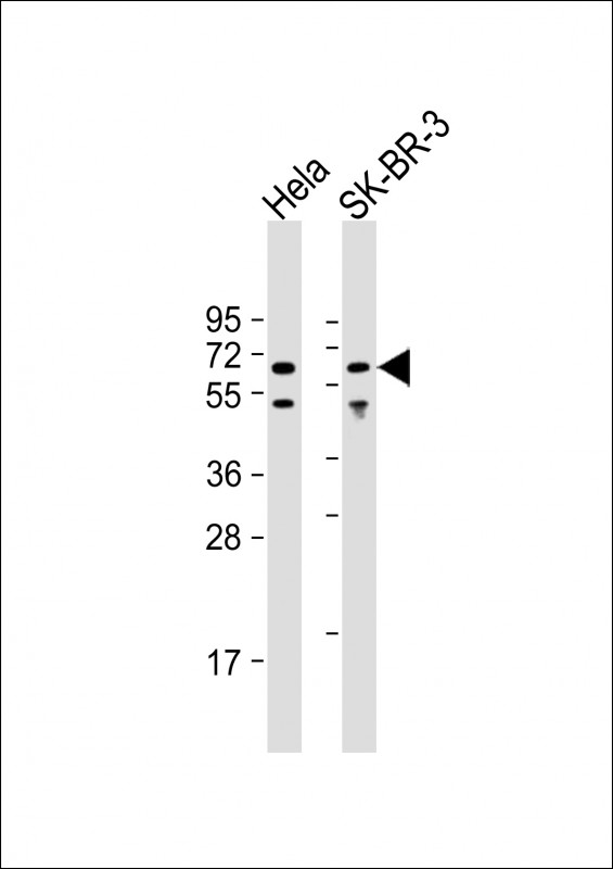WB - AMPK alpha 1 Antibody (C-term) AP7201a