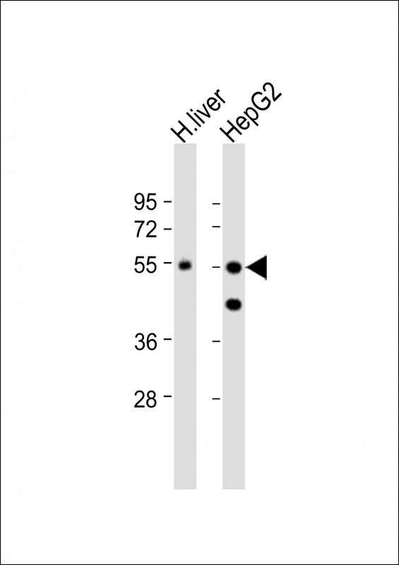 All lanes : Anti-CPN1 Antibody (N-term) at 1:1000 dilutionLane 1: human liver lysateLane 2: HepG2 whole cell lysateLysates/proteins at 20 �g per lane.  SecondaryGoat Anti-Rabbit IgG,   (H+L),  Peroxidase conjugated at 1/10000 dilution.  Predicted band size : 52 kDaBlocking/Dilution buffer: 5% NFDM/TBST.