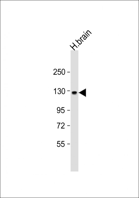 Anti-ACK1 Antibody (C946) at 1:1000 dilution + human brain lysateLysates/proteins at 20 �g per lane.  SecondaryGoat Anti-Rabbit IgG,   (H+L),  Peroxidase conjugated at 1/10000 dilution.  Predicted band size : 115 kDaBlocking/Dilution buffer: 5% NFDM/TBST.
