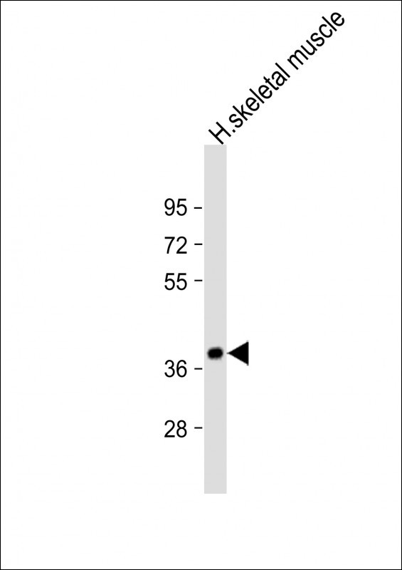 Anti-TRIB1 Antibody C-term at 1:2000 dilution + human skeletal muscle lysateLysates/proteins at 20 �g per lane. SecondaryGoat Anti-Rabbit IgG,  (H+L), Peroxidase conjugated at 1/10000 dilution. Predicted band size : 41 kDaBlocking/Dilution buffer: 5% NFDM/TBST.