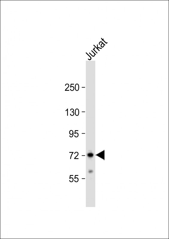 WB - ZFP36 Antibody (Center) AP8520c