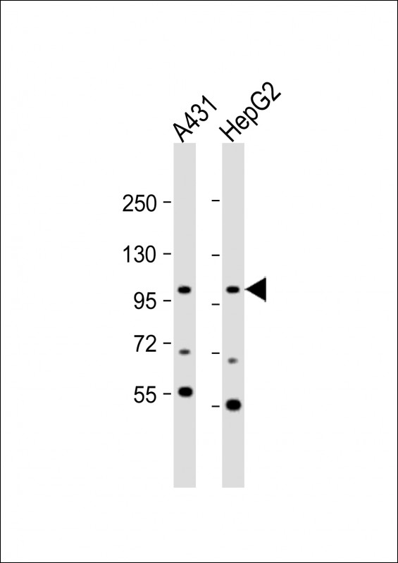 All lanes : Anti-AP2A2 Antibody (Center) at 1:1000 dilutionLane 1: A431 whole cell lysateLane 2: HepG2 whole cell lysateLysates/proteins at 20 �g per lane. SecondaryGoat Anti-Rabbit IgG,  (H+L), Peroxidase conjugated at 1/10000 dilution. Predicted band size : 104 kDaBlocking/Dilution buffer: 5% NFDM/TBST.