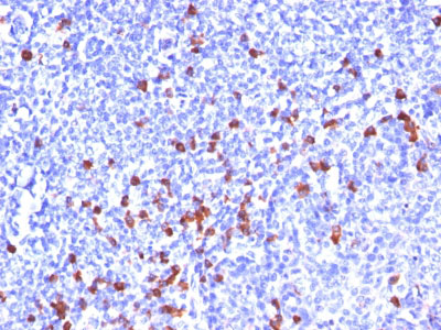 IHC -  Kappa Light Chain (B-Cell Marker) Antibody - With BSA and Azide AH10510-20