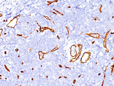 IHC -  CD34 (Hematopoietic Stem Cell & Endothelial Marker) Antibody - With BSA and Azide AH10875-20