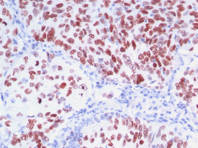 IHC -  TTF-1 / NKX2.1 (Thyroid & Lung Epithelial Marker) Antibody - With BSA and Azide AH12422-20