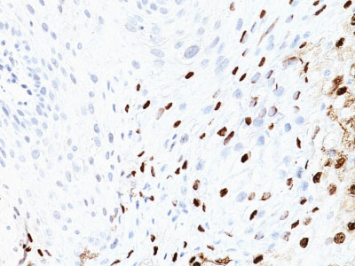 IHC -  HPV-16 (Human Papilloma Virus 16) Antibody - With BSA and Azide AH12874-20