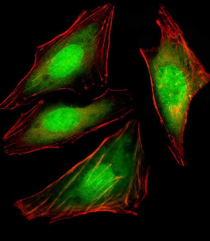 Immunofluorescent analysis of 4% paraformaldehyde-fixed, 0.1% Triton X-100 permeabilized HeLa (human cervical epithelial adenocarcinoma cell line) cells labeling TERA with AM8494b at 1/25 dilution, followed by Dylight� 488-conjugated goat anti-mouse IgG (NA166821) secondary antibody at 1/200 dilution (green). Immunofluorescence image showing cytoplasm and nucleus staining on HeLa cell line. Cytoplasmic actin is detected with Dylight� 554 Phalloidin (PD18466410) at 1/100 dilution (red).