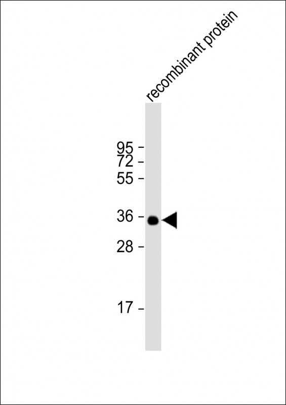 Anti-BRCA2 Antibody at 1:2000 dilution + recombinant proteinLysates/proteins at 20 �g per lane. SecondaryGoat Anti-mouse IgG,  (H+L), Peroxidase conjugated at 1/10000 dilution. Predicted band size : 384 kDaBlocking/Dilution buffer: 5% NFDM/TBST.