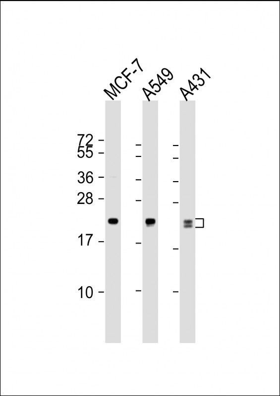 All lanes : Anti-RAB13 Antibody at 1:1000 dilutionLane 1: MCF-7 whole cell lysateLane 2: A549 whole cell lysateLane 3: A431 whole cell lysateLysates/proteins at 20 �g per lane. SecondaryGoat Anti-mouse IgG,  (H+L), Peroxidase conjugated at 1/10000 dilution. Predicted band size : 23 kDaBlocking/Dilution buffer: 5% NFDM/TBST.