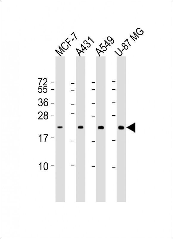 All lanes : Anti-RAB13 Antibody at 1:1000 dilutionLane 1: MCF-7 whole cell lysateLane 2: A431 whole cell lysateLane 3: A549 whole cell lysateLane 4: U-87 MG whole cell lysateLysates/proteins at 20 �g per lane.   SecondaryGoat Anti-mouse IgG,    (H+L),   Peroxidase conjugated at 1/10000 dilution.   Predicted band size : 23 kDaBlocking/Dilution buffer: 5% NFDM/TBST.