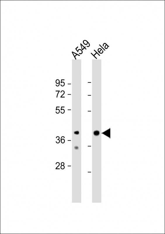WB - JMJD5 Antibody (N-term) AP10986a