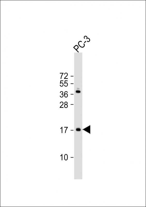 WB - NDUF3 Antibody (N-term) AP10989a
