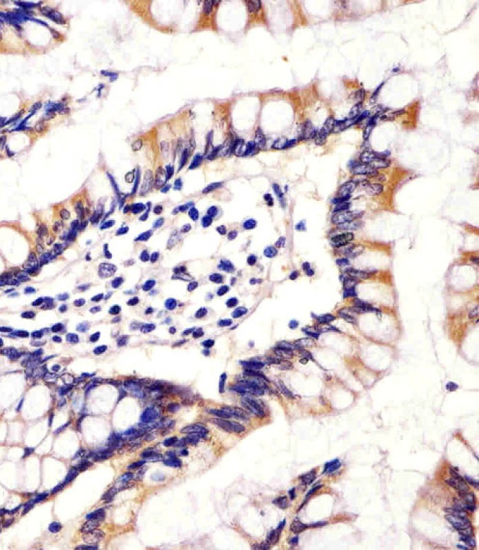 IHC-P - CYP11B2 Antibody (Center) AP11213C